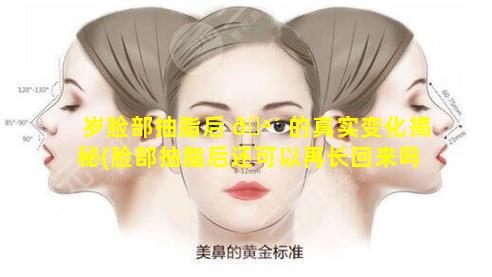 岁脸部抽脂后 🪴 的真实变化揭秘(脸部抽脂后还可以再长回来吗)